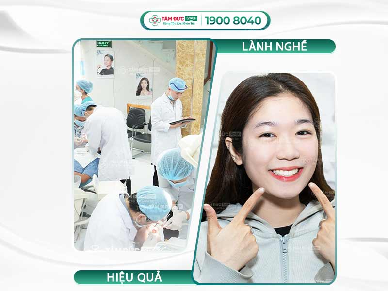 CÁCH CHỮA VIÊM NHA CHU RĂNG NẶNG