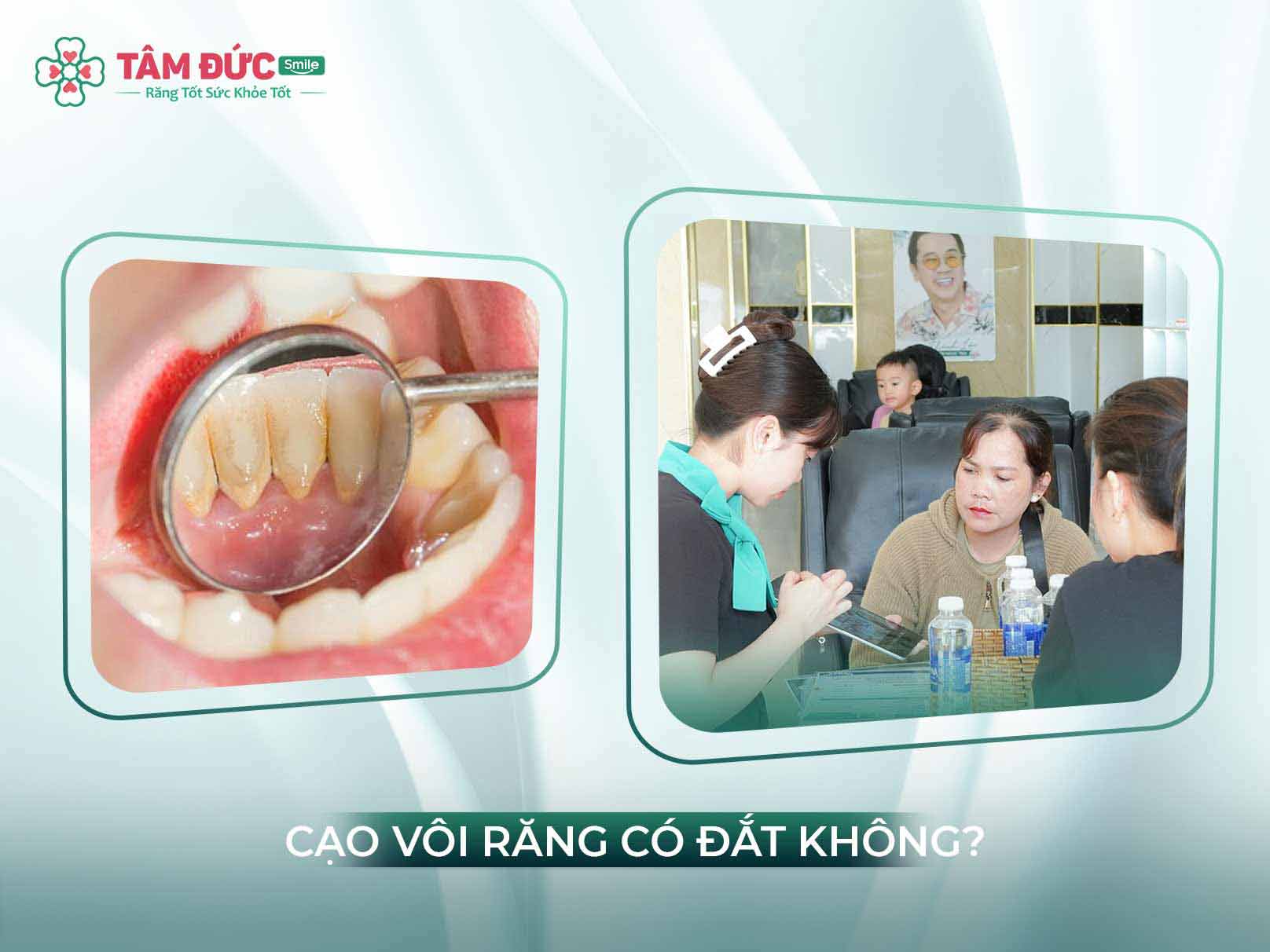 CHI PHÍ CẠO VÔI RĂNG GIÁ BAO NHIÊU TIỀN?