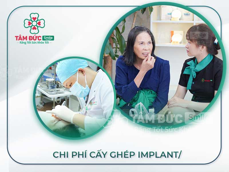CHI PHÍ CẤY GHÉP RĂNG IMPLANT THẾ NÀO LÀ PHÙ HỢP?