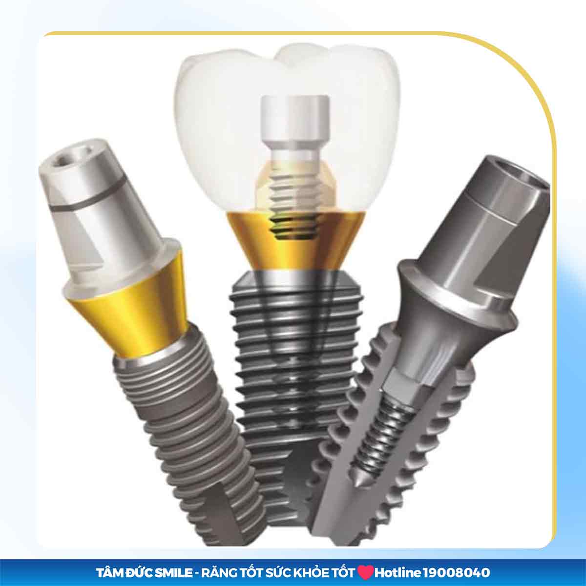 CHI PHÍ LẮP VÍT ABUTMENT IMPLANT GIÁ BAO NHIÊU?