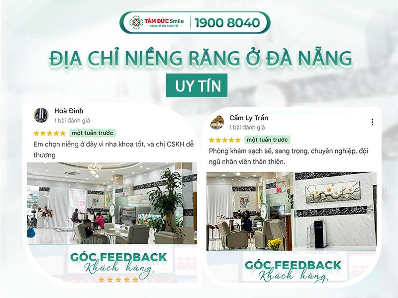 ĐỊA CHỈ NIỀNG RĂNG Ở ĐÀ NẴNG UY TÍN, CHỈ TỪ 10 TRIỆU/HÀM, TRẢ TRƯỚC 1 TRIỆU ĐỒNG, LÃI SUẤT 0%