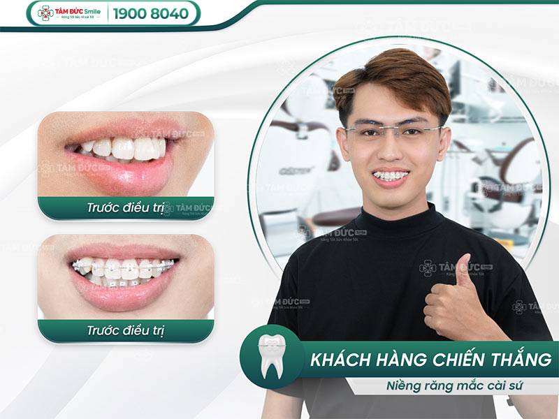 địa chỉ niềng răng ở Đà Nẵng uy tín