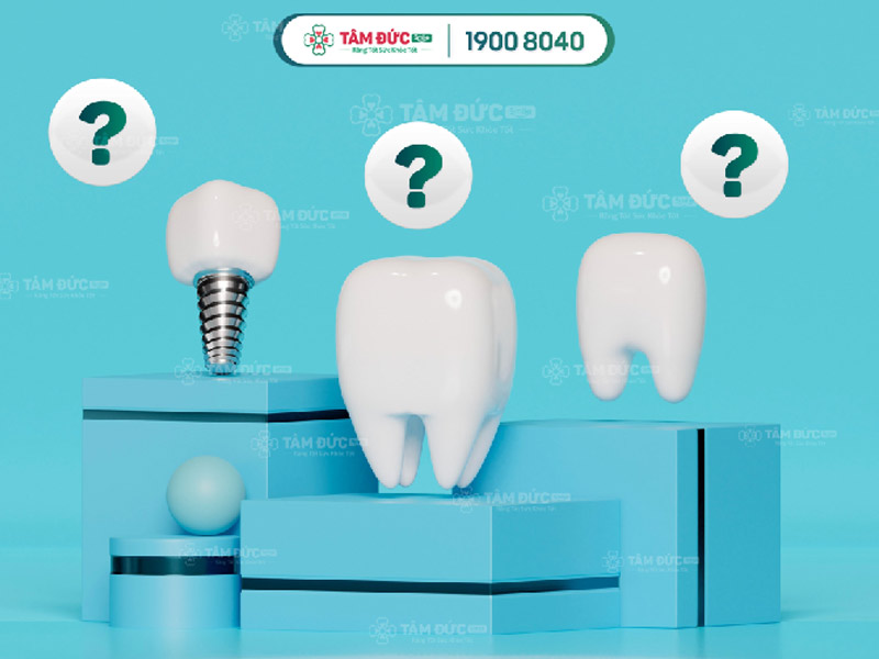 GIÁ TRỒNG RĂNG GIẢ - LÀM RĂNG GIẢ MỚI NHẤT 