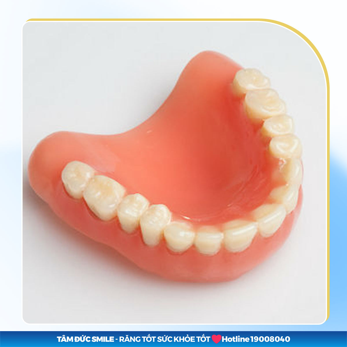 GIÁ TRỒNG RĂNG HÀM DƯỚI BAO NHIÊU TIỀN HIỆN NAY? 