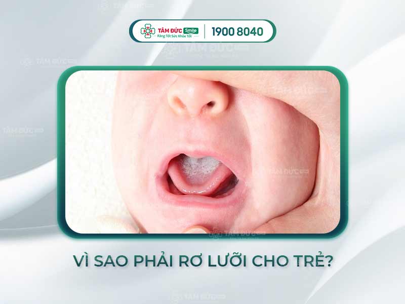 HƯỚNG DẪN CÁCH RƠ LƯỠI LẤY ĐỜM CHO TRẺ SƠ SINH AN TOÀN & HIỆU QUẢ