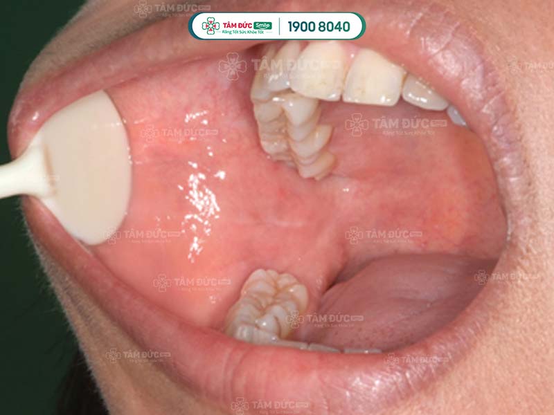 khoang miệng gồm những bộ phận nào