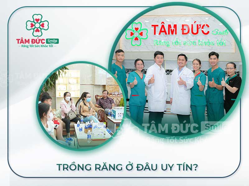 TRỒNG RĂNG GIẢ Ở ĐÂU TỐT NHẤT? GIÁ BAO NHIÊU TIỀN?