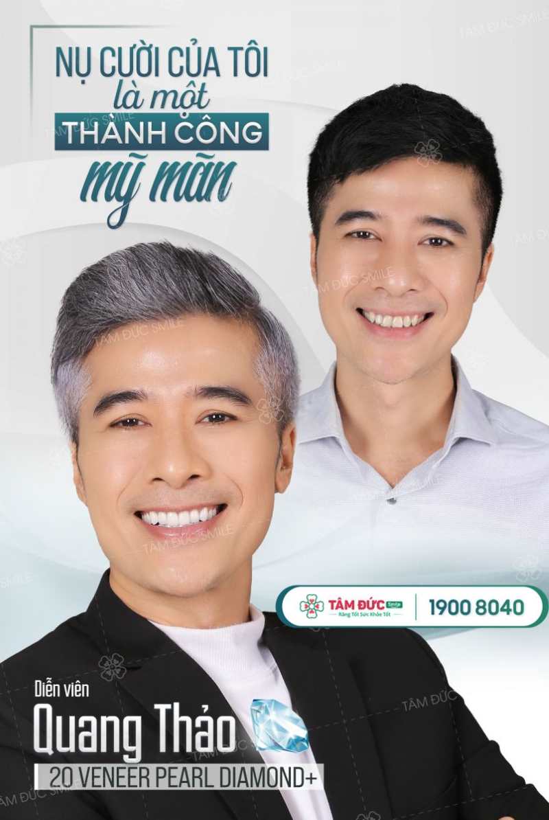 diễn viên Quang Thảo dán sứ veneer tại nha khoa Tâm Đức Smile