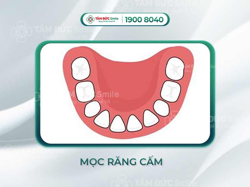 MỌC RĂNG CẤM BỊ ĐAU PHẢI LÀM SAO? RĂNG CẤM CÓ PHẢI RĂNG KHÔN HAY KHÔNG?