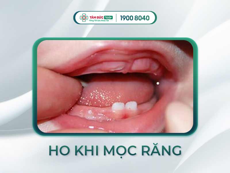 MỌC RĂNG CÓ HO KHÔNG? TRẺ BỊ HO CÓ NGUY HIỂM KHÔNG? CÁCH KHẮC PHỤC