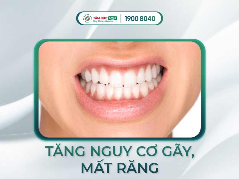 NGHIẾN RĂNG LÀ BIỂU HIỆN CỦA BỆNH GÌ? CÁCH CHỮA TẬT NGHIẾN RĂNG HIỆU QUẢ