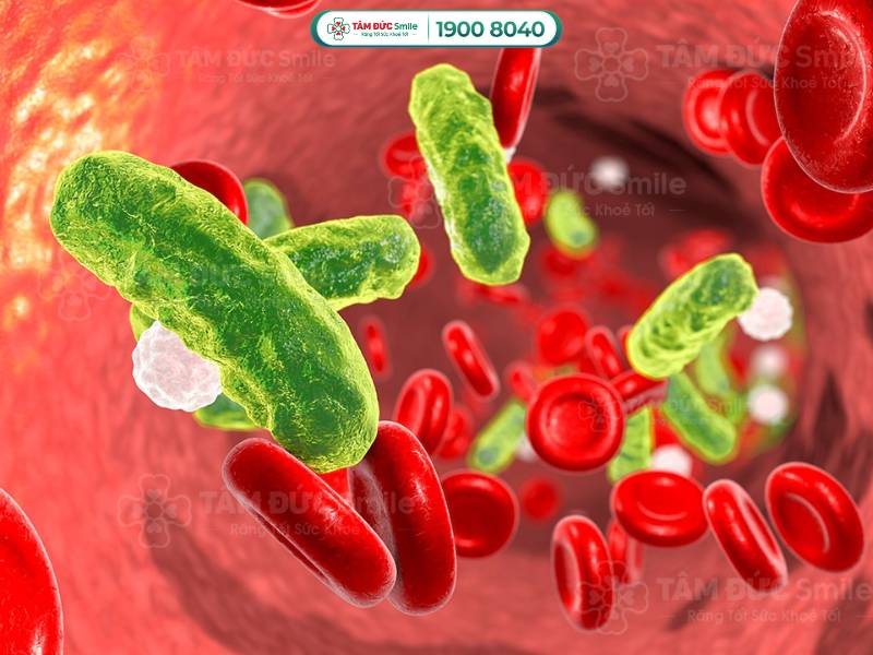 nhiễm trùng răng có nguy hiểm không