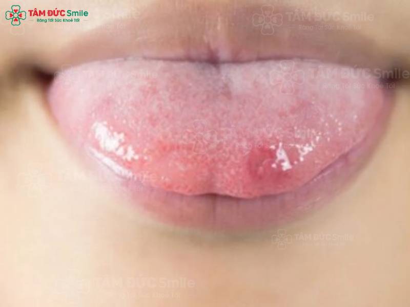 niêm mạc miệng là gì