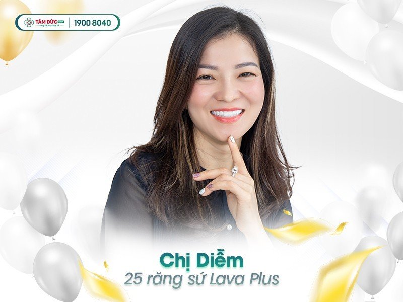 Chị Diễm sau khi bọc răng sứ tại nha khoa Tâm Đức Smile