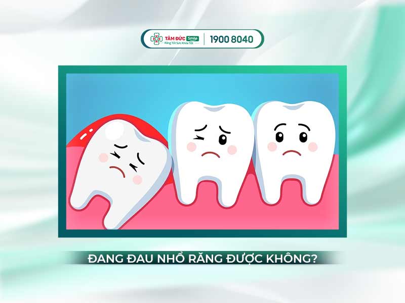 RĂNG KHÔN ĐANG ĐAU CÓ NHỔ ĐƯỢC KHÔNG?