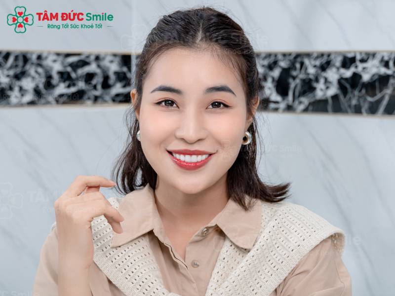 rãnh cười là gì