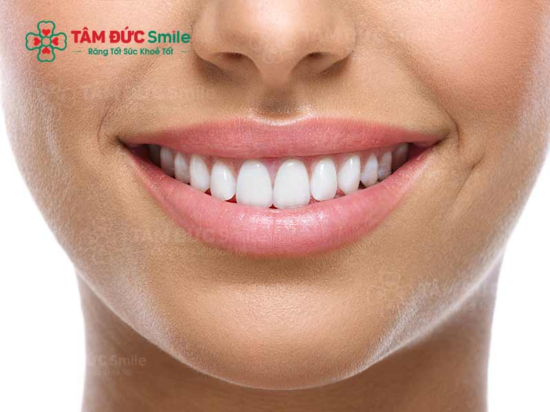 rãnh cười là gì