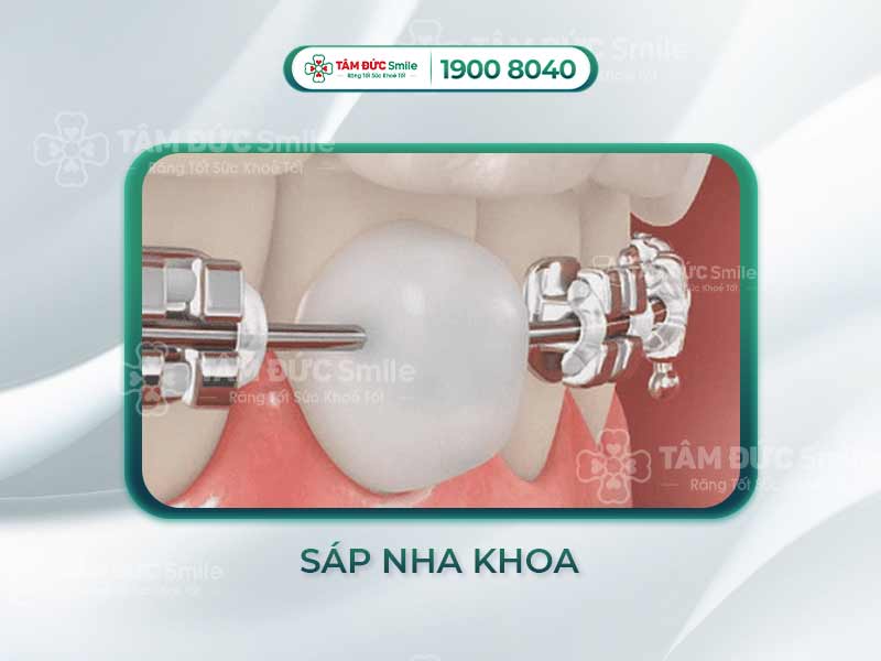 SÁP NHA KHOA NUỐT ĐƯỢC KHÔNG? NHỮNG LƯU Ý QUAN TRỌNG