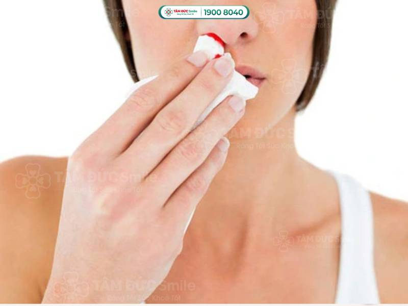 tại sao chảy máu cam