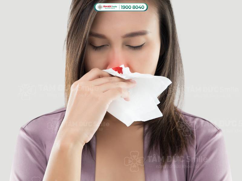 tại sao chảy máu cam