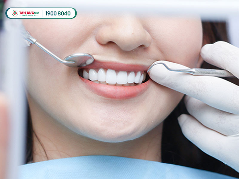 tẩy trắng răng có đau không