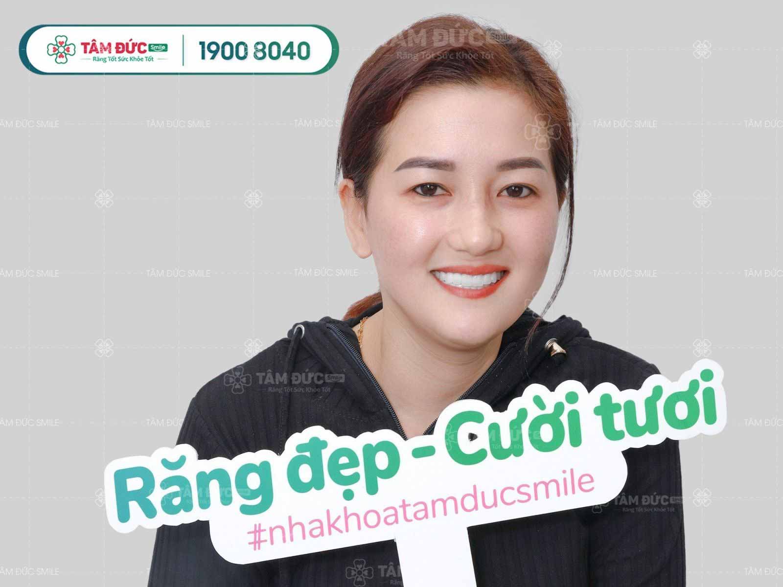 tẩy trắng răng không đau tại nha khoa Tâm Đức Smile