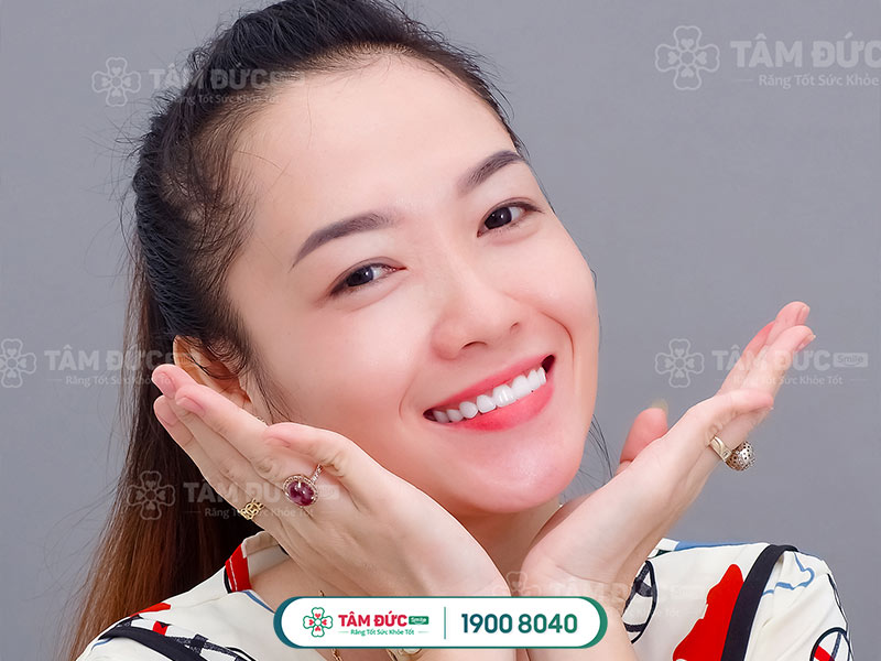 giá tẩy trắng răng tại nhà