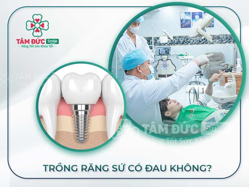 TRỒNG RĂNG SỨ CÓ ĐAU KHÔNG? TRỒNG RĂNG Ở ĐÂU UY TÍN?