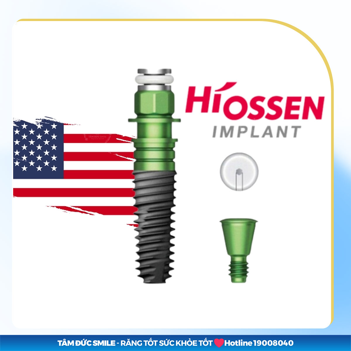 TRỤ IMPLANT HIOSSEN: XUẤT XỨ VÀ ƯU ĐIỂM ĐÁNG ĐỒNG TIỀN