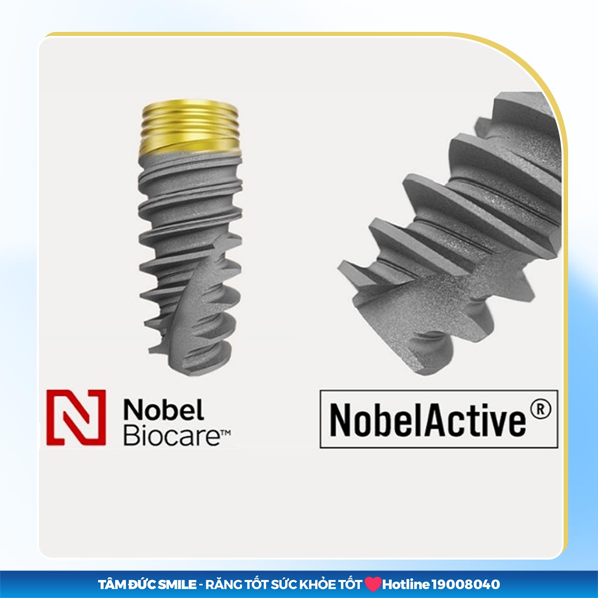 TRỤ IMPLANT NOBEL ACTIVE - IMPLANT TỨC THÌ ĐẲNG CẤP THẾ GIỚI