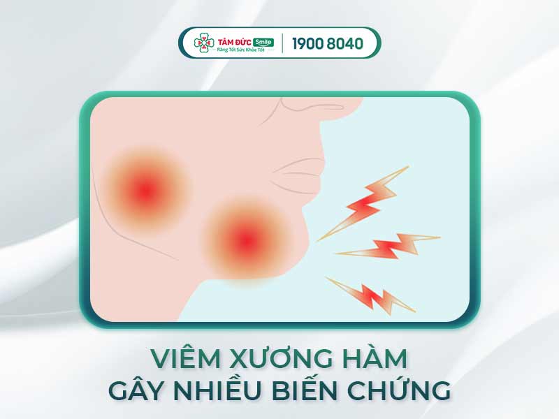 VIÊM XƯƠNG HÀM CÓ NGUY HIỂM KHÔNG? CÁCH ĐIỀU TRỊ DỨT ĐIỂM